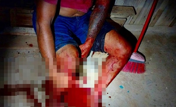 Tentativa de homicídio em Colniza: homem é baleado enquanto dormia em sua casa 