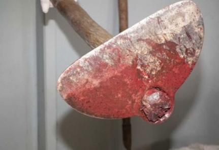 Homem tenta matar o irmão com golpe de enxada na cabeça 